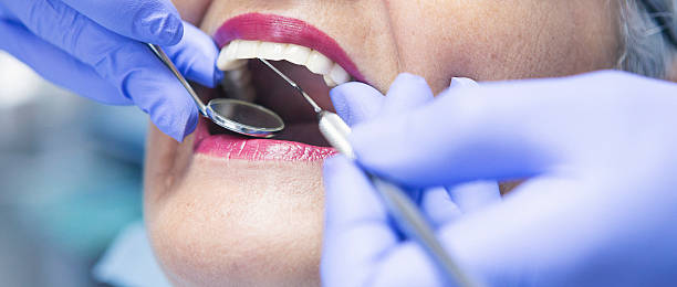 Best Same-Day Emergency Dental Services in Lake Wildwood, CA